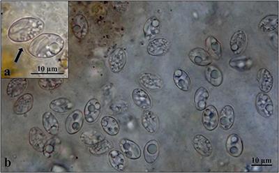 Molecular Identification of Sarcocystis sp. (Apicomplexa, Sarcocystidae) in Offspring of Tengmalm's <mark class="highlighted">Owl</mark>s, Aegolius funereus (Aves, Strigidae)